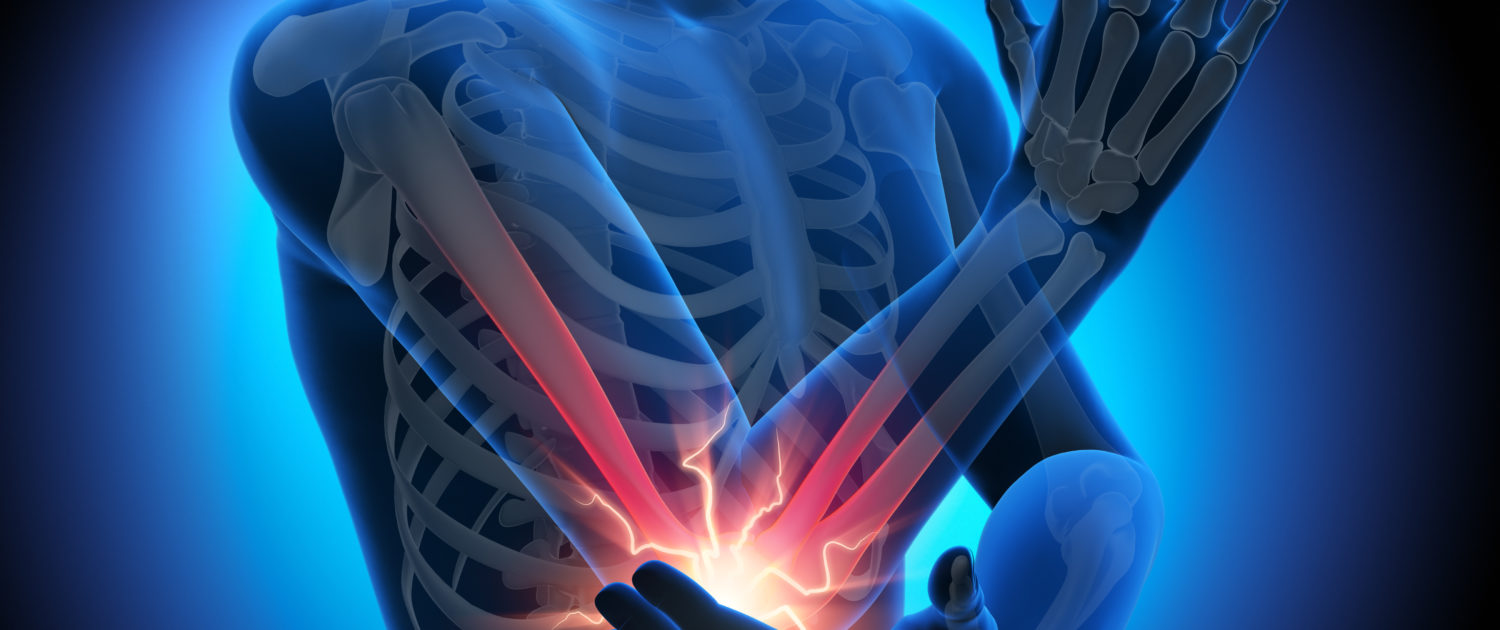 Schmerz im Ellbogengelenk